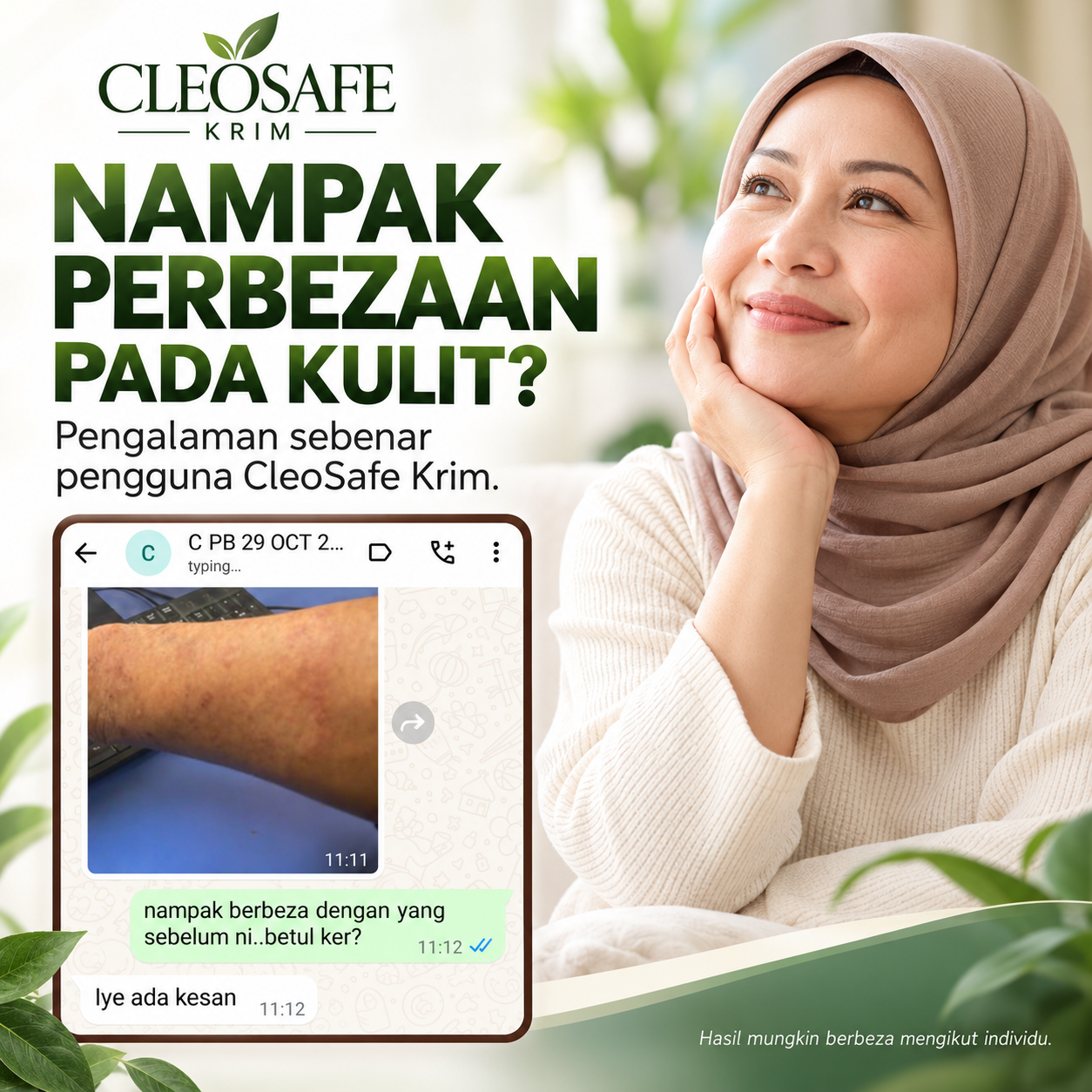 Poster perbualan pengguna mengenai kulit lengan