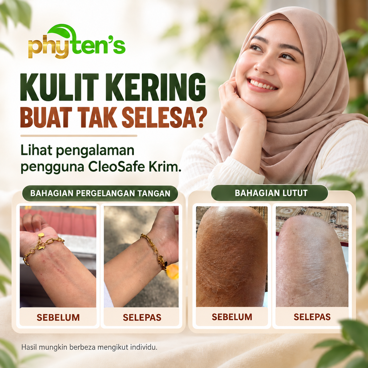 Poster foto sebelum dan selepas pada pergelangan tangan dan lutut