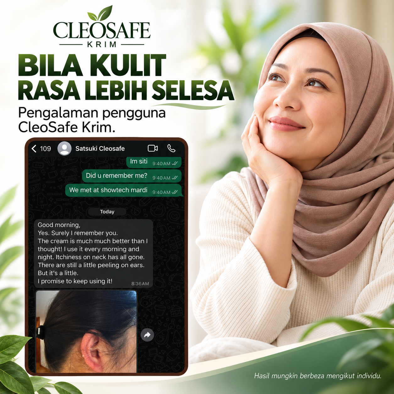 Poster perbualan pengguna mengenai kulit leher dan telinga